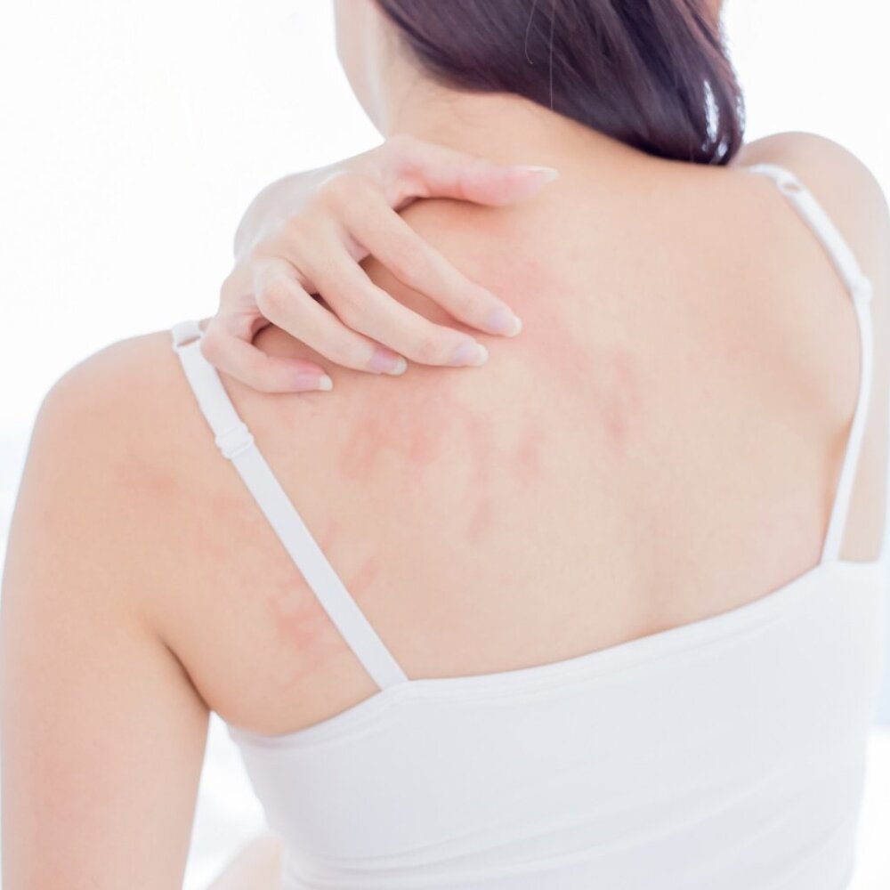 Renew Eczema Relief COLLOIDAL OATMEAL, USP-GRADE PETROLATUM PLANT-BASED GLYCERIN - Picture 9 of 16